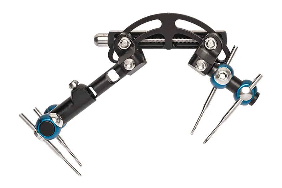 Fijador externo con aplicación dorsal – Dupuytren · imagen 2