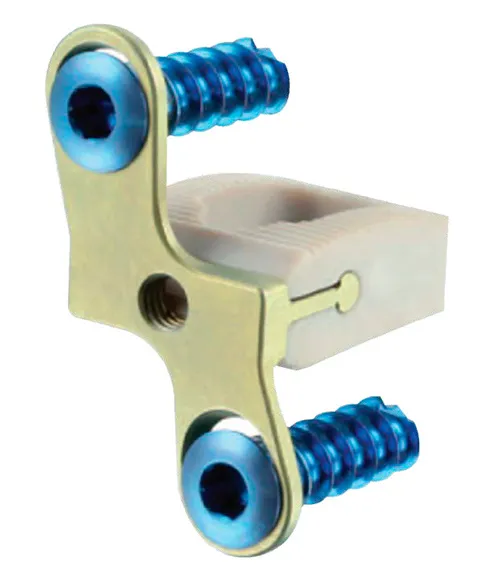 DOMINO – Sistema de jaula cervical